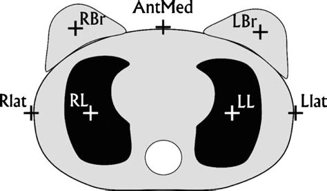 Schematic Drawing Of Cirs Thorax Phantom In Caudal View Marked Are The Download Scientific