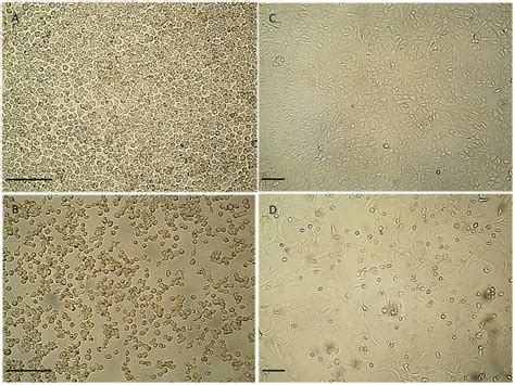 Cytopathic effect in infected and uninfected cell cultures. Cytopathic... | Download Scientific ...