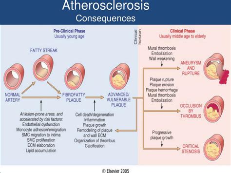 Ppt Atherosclerosis Cvs Lecture 2 Atherosclerosis Powerpoint Presentation Id 2135750