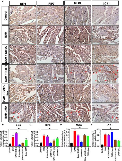 Frontiers Rip1rip3mlkl Mediates Myocardial Function Through