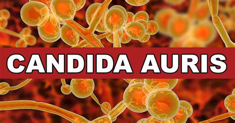 Do You Know What Candida Auris Is You Should Supermarketguru