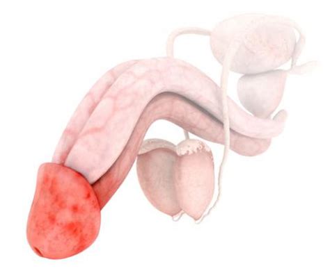 Puntos Rojos En El Glande Causas S Ntomas Y Tratamiento Urologos Peru