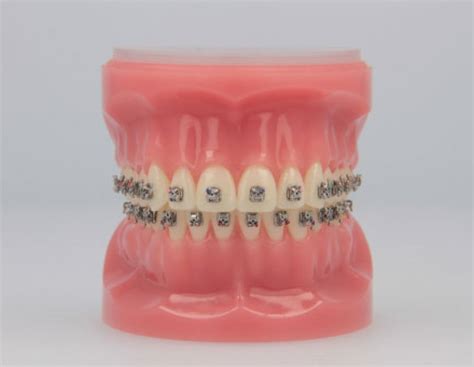 Virtual Product Library American Orthodontics