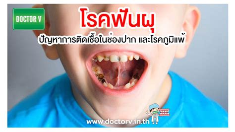 โรคฟันผุ ปัญหาการติดเชื้อในช่องปาก และโรคภูมิแพ้