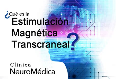 Qu Es La Estimulaci N Magn Tica Transcraneal