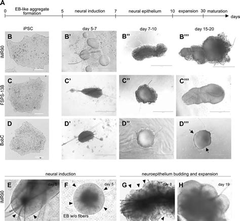 Generation Of Cerebral Organoids From Different Induced Pluripotent