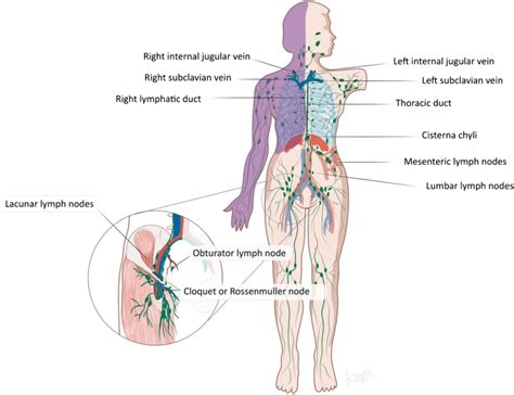 Diagram Shows Normal Lymphatic Anatomy Distribution Note That The