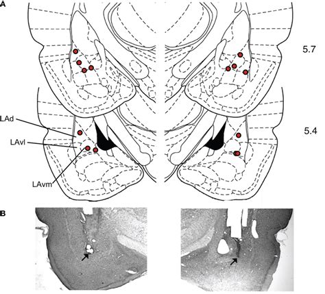 Histological Verification Of Cannula Placements In The LA A Rats