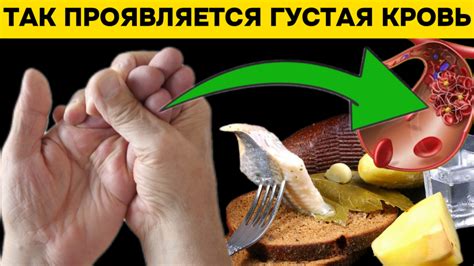 Неочевидные признаки густой крови, ее причины и что с этим делать ...