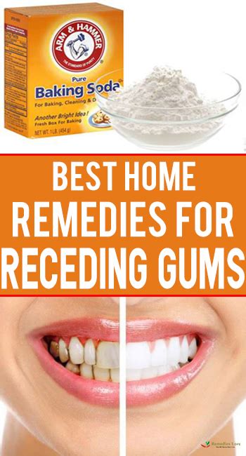 Best Home Remedies For Receding Gums - Remedies Lore