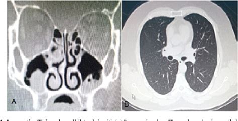 Figure 1 From International Journal Of Surgery Case Reports A Case