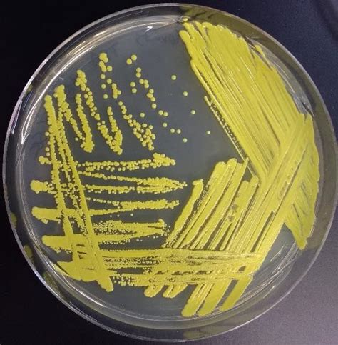 Streaking For Isolation Microbiology Laboratory Manual