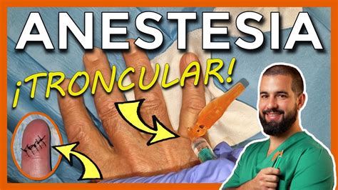 C Mo Poner Anestesia Para Suturar Un Dedo Anestesia Troncular Video