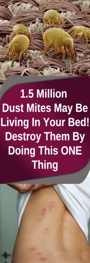 1 5 Million Dust Mites May Be Living In Your Bed Destroy Them By Doing This One Thing Asthma