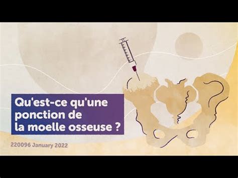 Partie Vid O Qu Est Ce Qu Une Ponction De Moelle Osseuse