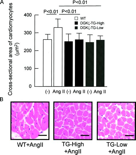 Cardiac Specific Overexpression Of Diacylglycerol Kinase Prevents Gq