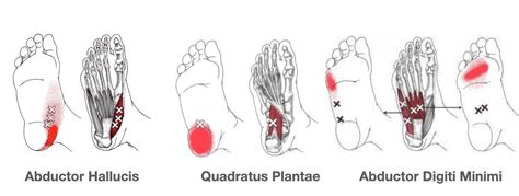 Self Massage Techniques For Trigger Points In Your Feet