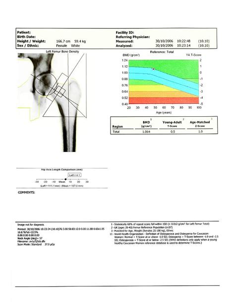 Bone Density Scan Photograph by Saturn Stills | Fine Art America