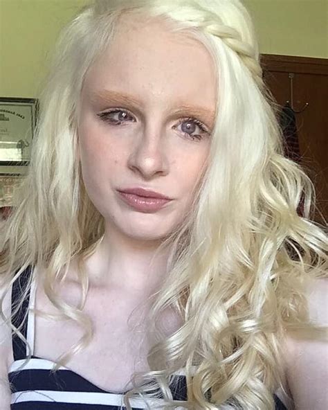 Albino Woman Becomes Tiktok Star Thanks To Violet Colored Eyes Users Call Her Supernatural