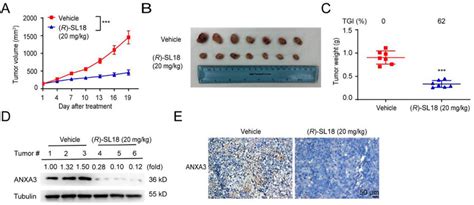 R Sl18 Suppressed Tumor Growth In Tnbc Pdx Model A Tumor Growth