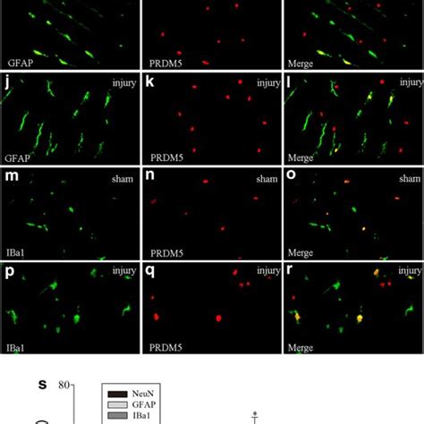 Double Immunofluorescence Staining For PRDM5 And Different