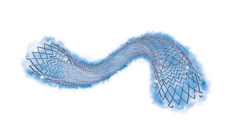 Mount Sinai Is First To Use Fda Approved Drug Eluting Stent That Treats Pad