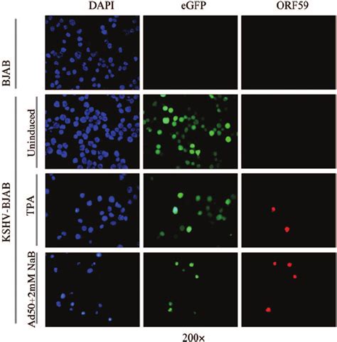 Photomicrographs Of Kshv Bjab Cells 48 H Postinduction Showing 4 Ј 6 Ј Download Scientific