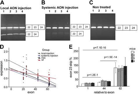 Exon Skipping Does Not Influence Transcript Imbalance Ac Agarose Gels