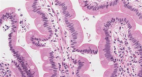 Giardia Infection Of The Duodenum Ottawa Atlas Of Pathology