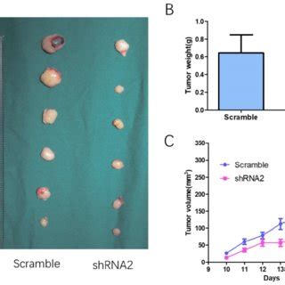 CTSB Knockdown Attenuates Tumor Growth Of HL 60 Cells In Nude Mice