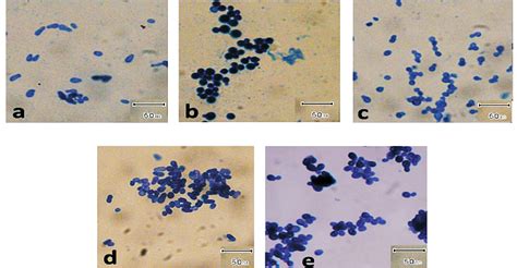 Figure 1 From Association Of Malassezia Species With Dandruff