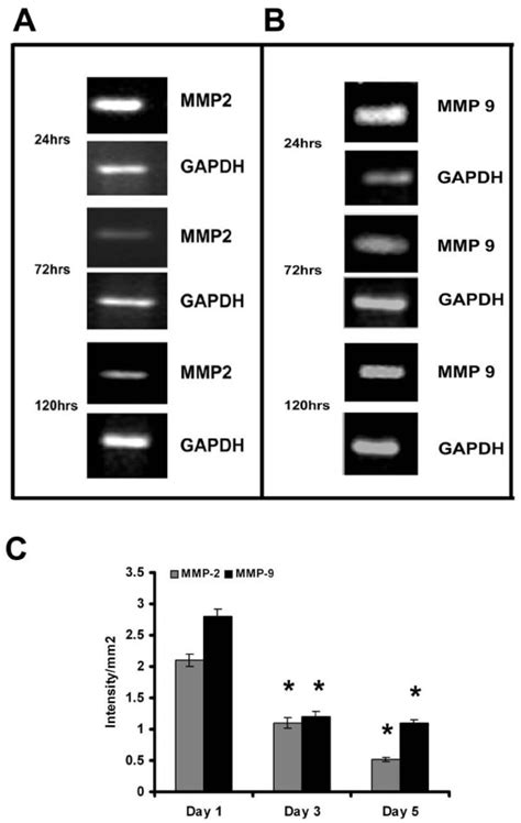 Expression Of MMP 2 And MMP 9 In HUVECs RT PCR Cells Were Maintained