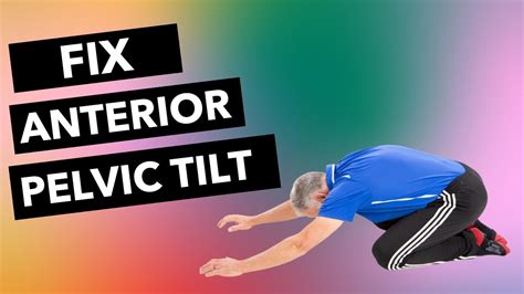 Fix Anterior Pelvic Tilt 4 Critical Exercises Youtube