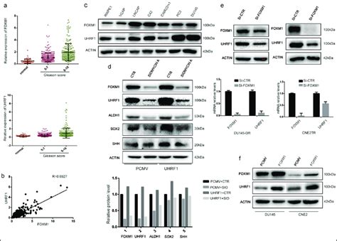 Foxm1 And Uhrf1 Are Consistently Expressed In Prostate Cancer Tumor