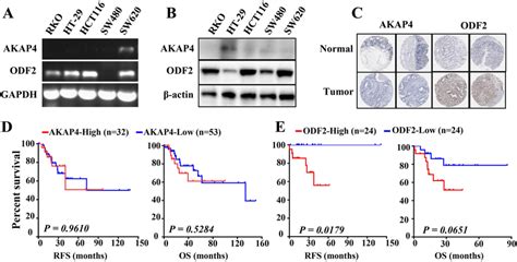 Akap And Odf Expression Level And Prognosis Value In Non Msi H Crc