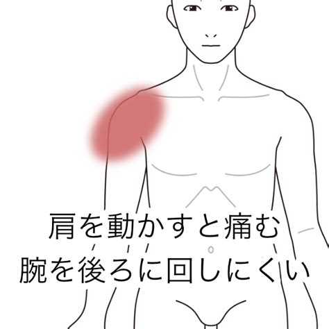 肩の前面と三角筋が痛む｜肩痛（スポーツ障害・怪我）のツボ｜ツボネット 鍼灸の症例が検索できるツボ辞典