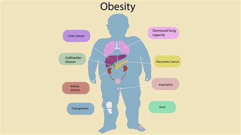 Fast Five Quiz Obesity Comorbidities