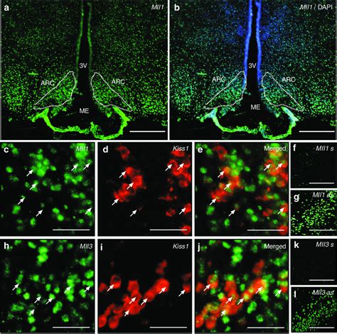 Mll1 And Mll3 Mrna Transcripts In Kndy Neurons Of Late Juvenile Female Download Scientific