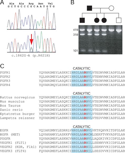 A Novel Mutation In Fgfr Causes Camptodactyly Tall Stature And