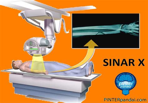 Contoh Soal Sinar X Homecare24