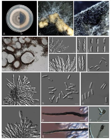 Colletotrichum Fructicola Facesoffungi Number FoF 06767 Faces Of Fungi