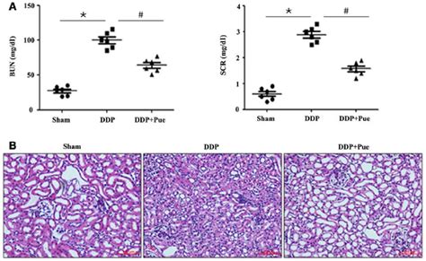 Effect Of Puerarin On DDP Induced Renal Injury A BUN And SCR