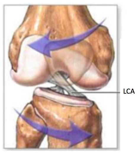 Lesões do ligamento cruzado anterior LCA Dr Leandro Calil