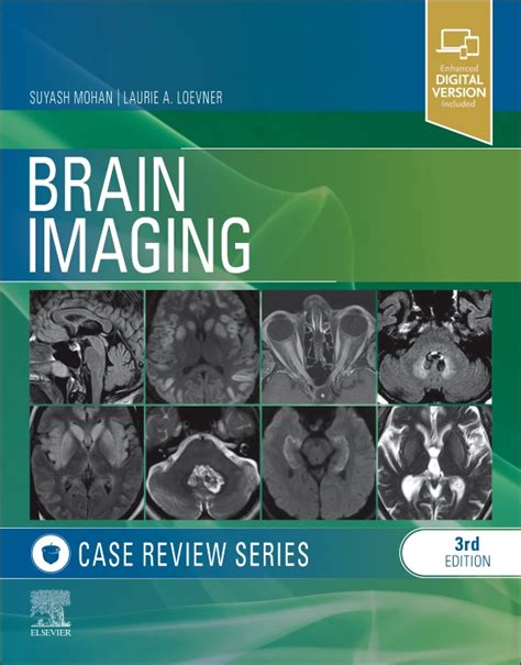 Brain Imaging Case Review Series Edition By Suyash Mohan Md And