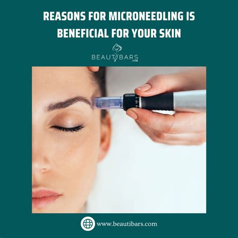 13 Reasons Microneedling Is Beneficial For Your Skin Medspa Allen Tx