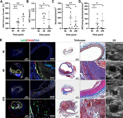 Reducing Abdominal Aortic Aneurysm Progression By Blocking Neutrophil