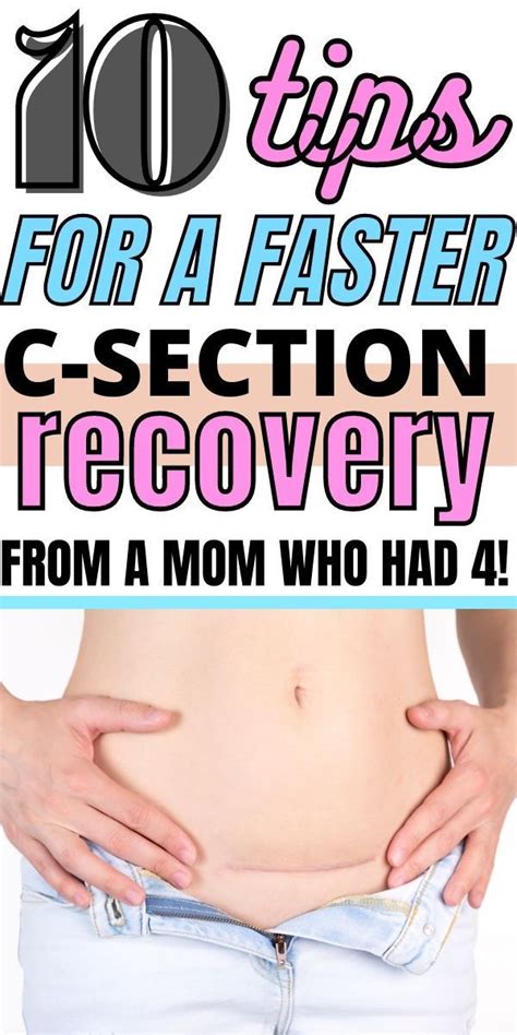 10 Tips For A Fast C Section Recovery Artofit