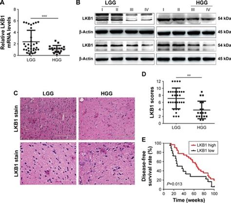 Full Article Lkb1 Suppresses Glioma Cell Invasion Via Nf κb Snail