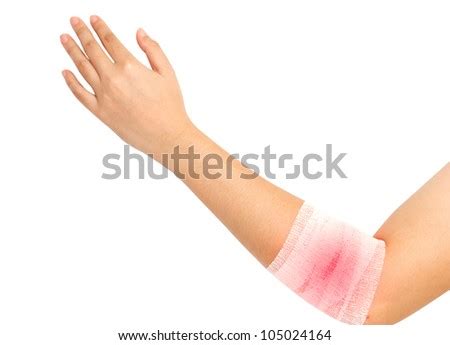 Forearm And Elbow Injury Strain Sprained In White Bandage On Isolate