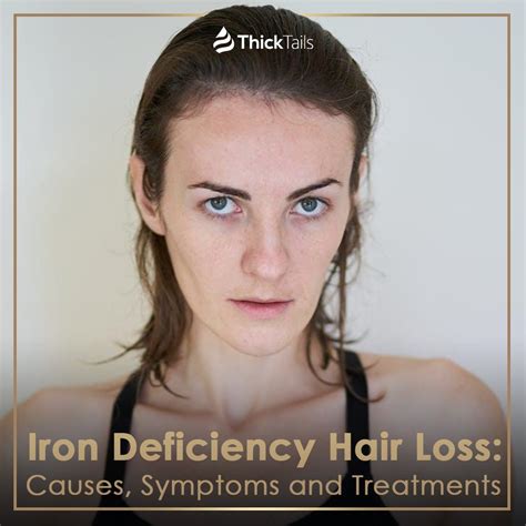 Iron Deficiency Hair Loss: Causes, Symptoms and T...